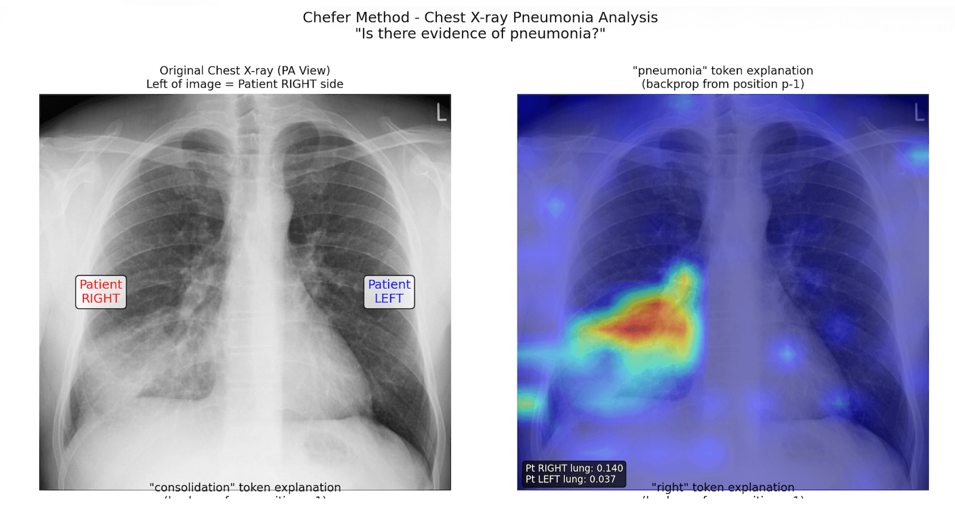 Opening the Black Box: How to See What Your Vision Language Model is Actually Looking At
